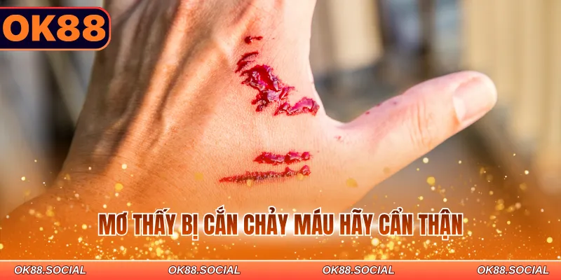 Mơ thấy bị cắn chảy máu hãy cẩn thận